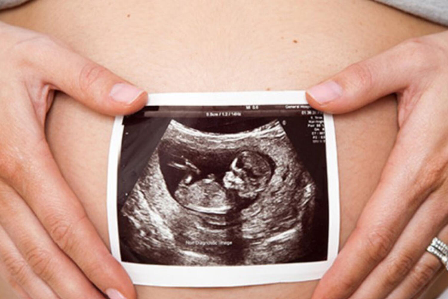 Sweet Pea 4D Baby to Be Imaging